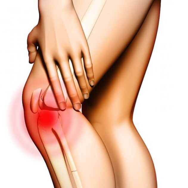 ból kolana z artrozą