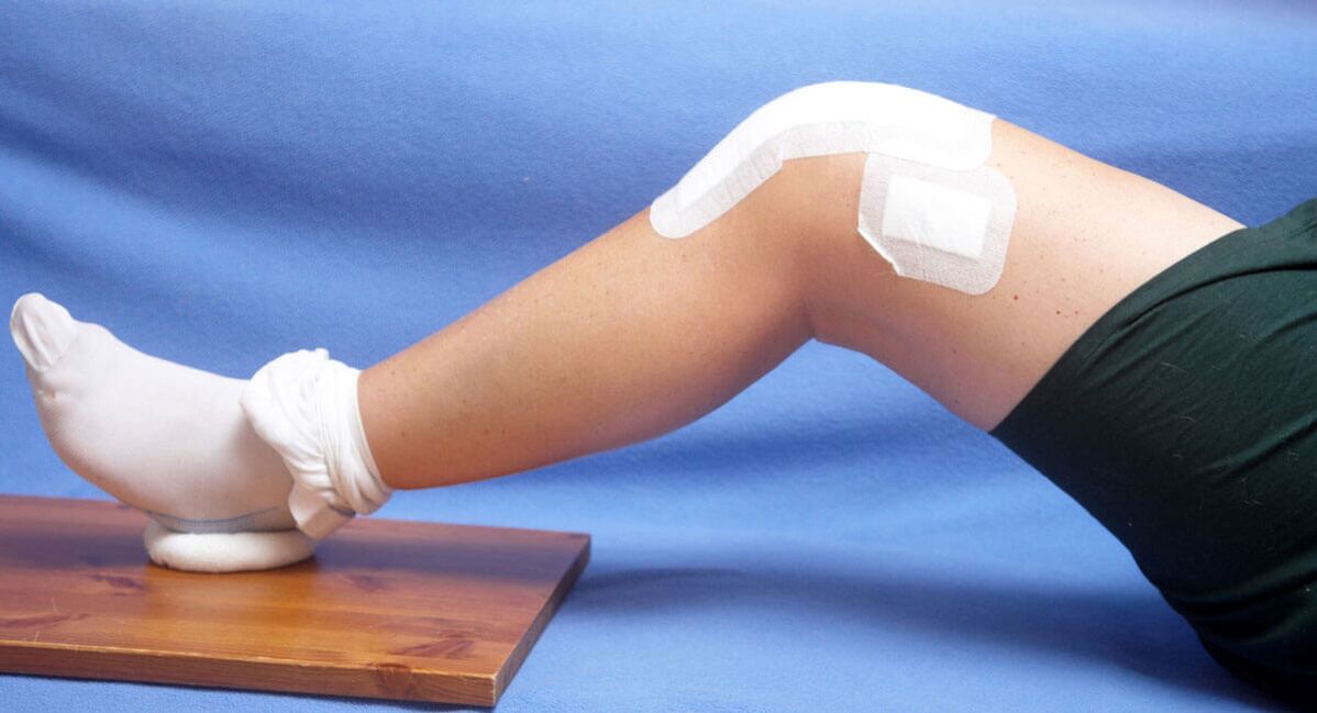uraz kolana jako przyczyna artrozy