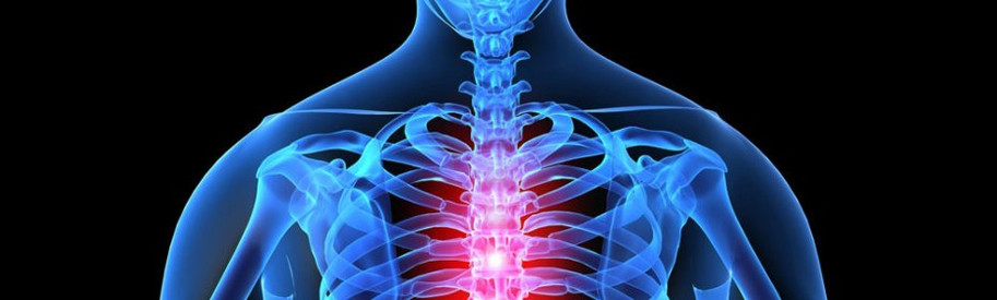 Osteochondroza odcinka piersiowego kręgosłupa