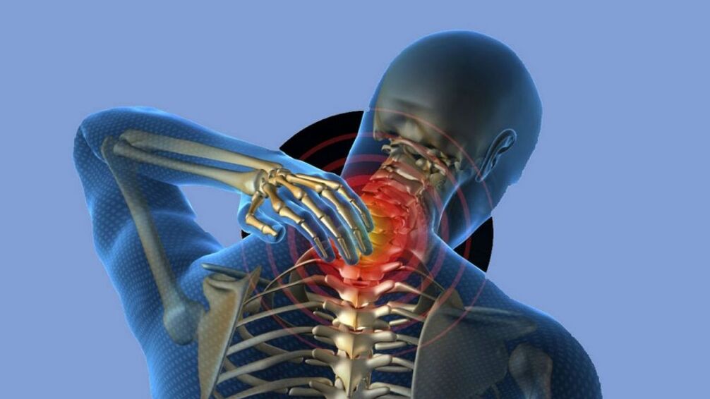 Osteochondroza obszaru szyjki macicy