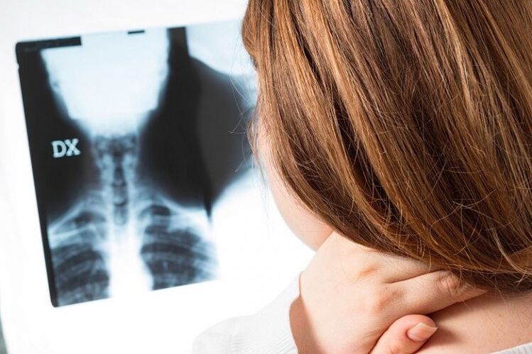 X -Ray w regionie szyjki macicy
