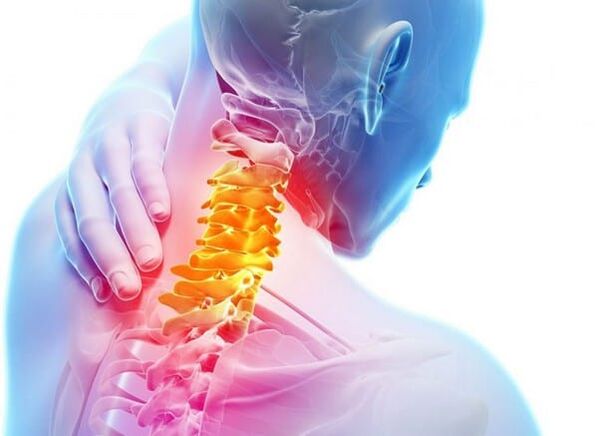 Osteochondroza kręgosłupa szyjnego