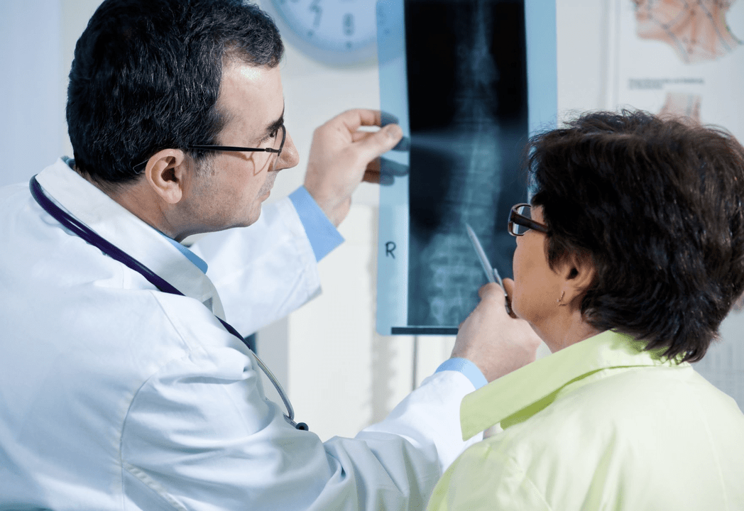 Neurolog diagnozuje osteochondrozę za pomocą radiografii kręgosłupa