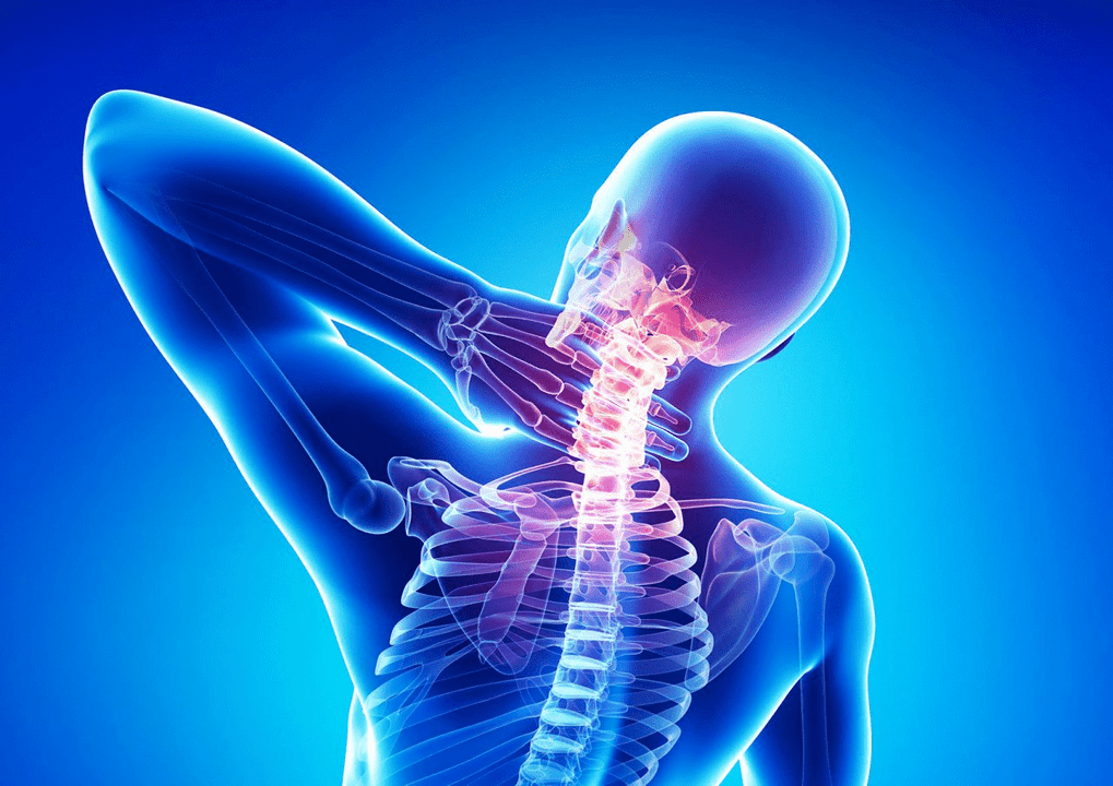 Osteochondroza kręgosłupa