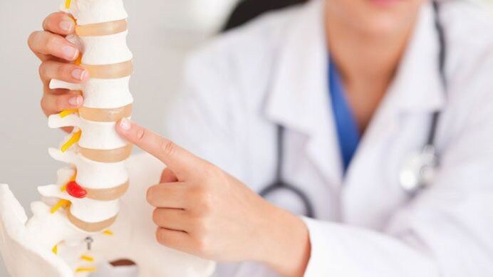 wyjaśnienie osteochondrozy lędźwiowej na modelu kręgosłupa